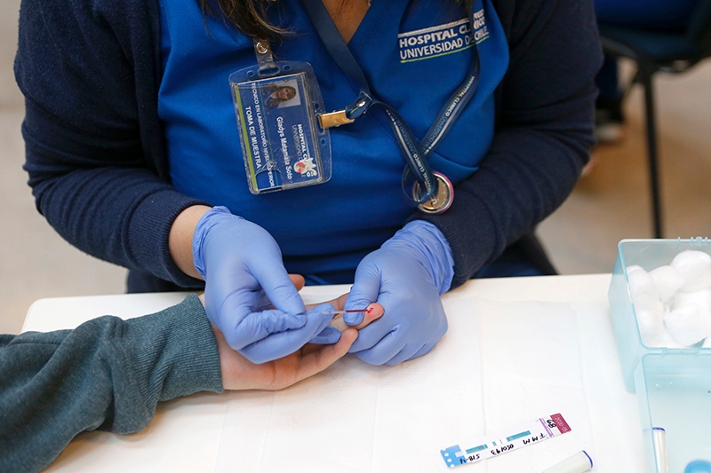 Test de diagnóstico del VIH cayeron más de 50 por ciento en pandemia