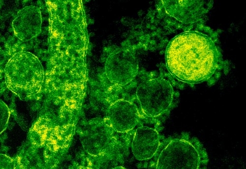 Físicos descubren que mayor diversidad de las bacterias favorece su poder de aglomeración