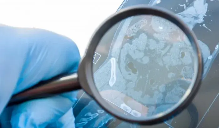 Norma sobre enfermedades poco frecuentes pasa a Comisión de Hacienda